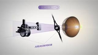 Videovorschau: What's with all these Rings?  MRT Explained